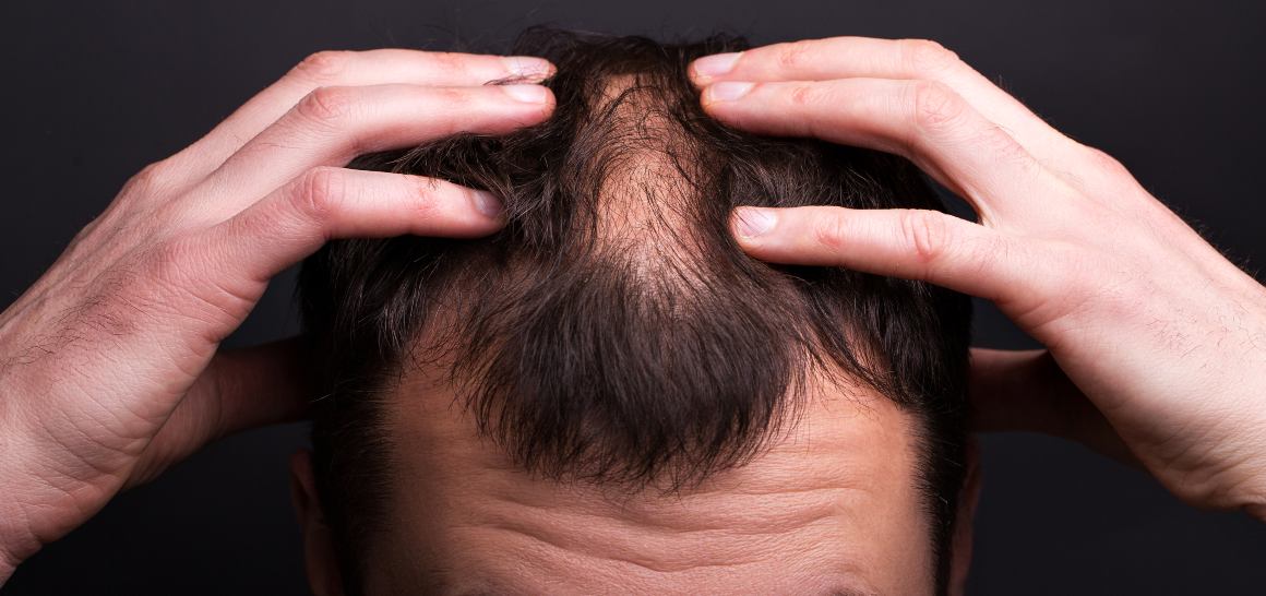 Kan CBD-olja hjälpa ditt hår att växa?