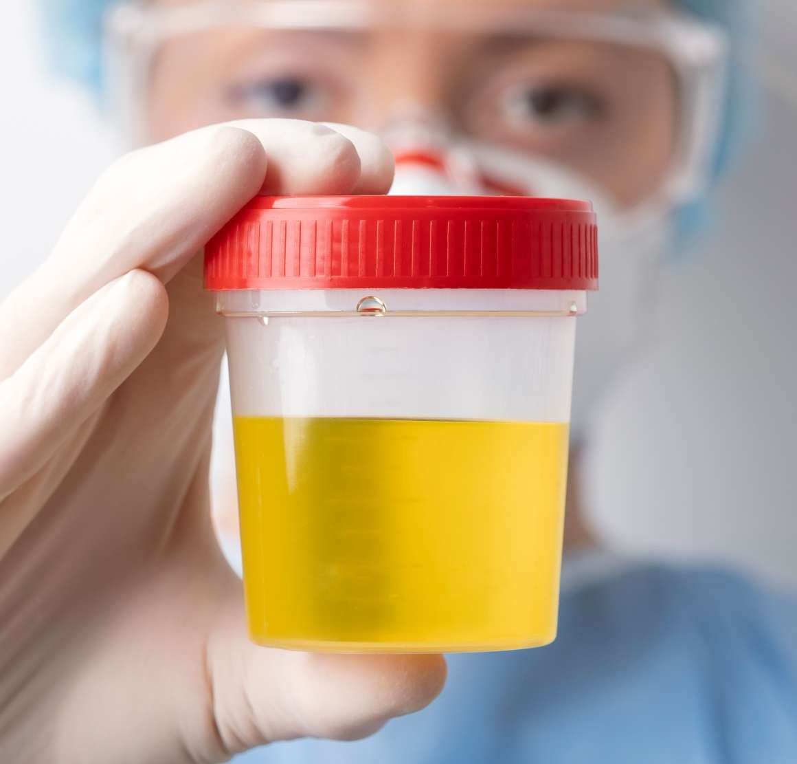 hur länge är cbd detekterbart i urin