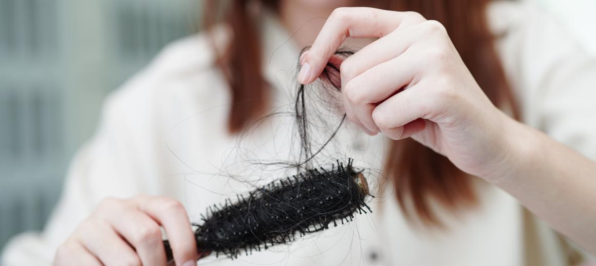 Undernäring kan leda till håravfall - men det är ofta reversibelt med rätt kost