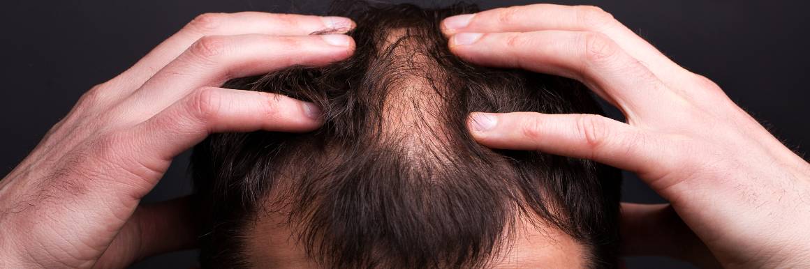 Reparerar skadade hårsäckar för sund hårväxt